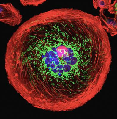 Cover image for research topic "Tackling Breast, Brain, Lung and Ovarian Cancer with Nanomediated Delivery Systems:  New Horizons in Cancer Treatment"
