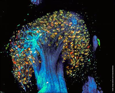 Cover image for research topic "Peripheral and Central Pain Processes"