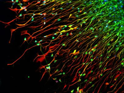 Cover image for research topic "Developmental Brain Diseases Through the Lens of iPS Cells and Organoids"