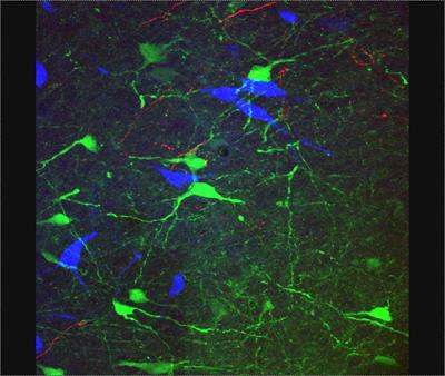 Cover image for research topic "Medial Septum and Magnocellular Basal Forebrain: Cellular Function, Pathology and Behavior"
