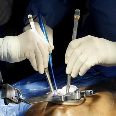 Cover image for research topic "Graft Preservation"