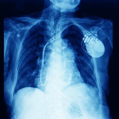 Cover image for research topic "Rising Stars in Cardiac Rhythmology: 2023"