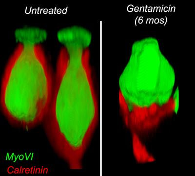 Cover image for research topic "Cellular Mechanisms of Ototoxicity"