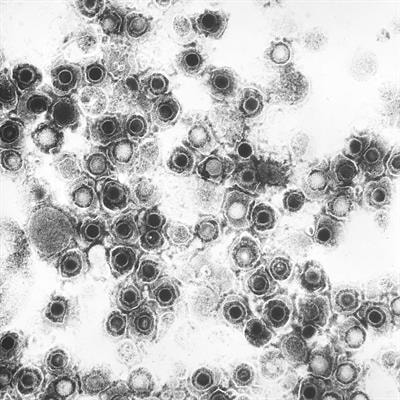 Cover image for research topic "Herpesvirus: Transmission, Pathogenesis, Host-Pathogen Interaction, and Treatment"