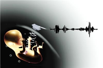 Cover image for research topic "Recent Advances in Doppler Signal Processing and Modelling Techniques for Fetal Monitoring"