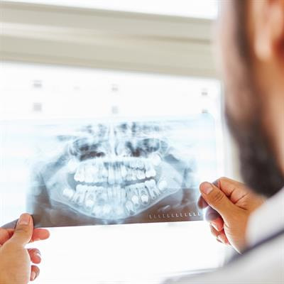 Cover image for research topic "The Future of Third Molar Surgery"