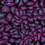 Cover image for research topic "Tendencies and new horizons for digital health use in the gynecological cancer patient journey"