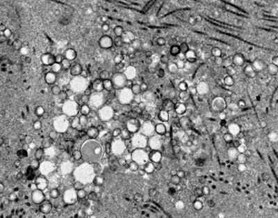 Cover image for research topic "Extracellular Vesicle-Mediated Processes in Cardiovascular Diseases"