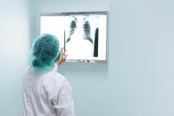 Cover image for research topic "Lung Adenocarcinoma: From Genomics to Immunotherapy"