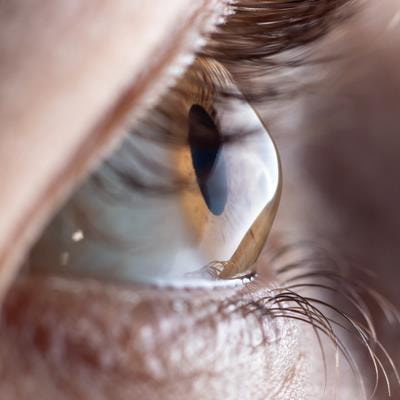 Cover image for research topic "Women in Lens and Cataract"
