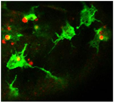 Cover image for research topic "Apoptotic Cell Clearance in Health and Disease"
