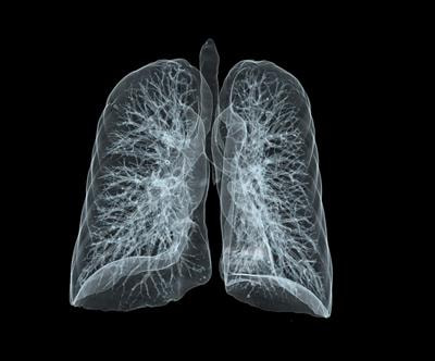 Cover image for research topic "Recent Advances in Surgical Management of NSCLC"