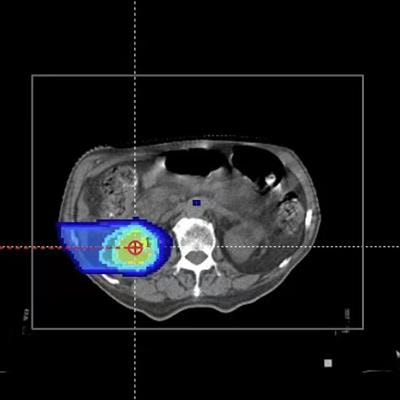 Cover image for research topic "Physical, Biological, Clinical, and Methodological Advances in Particle Therapy"