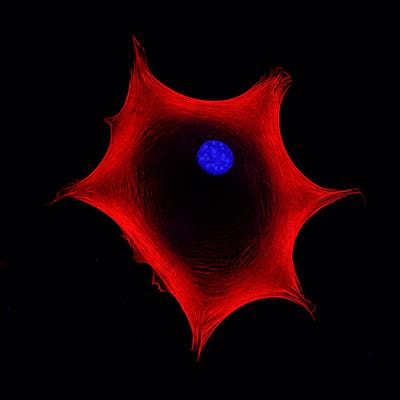 Cover image for research topic "Studying Rare Diseases Using induced Pluripotent Stem Cell (iPSC)-based Model Systems"