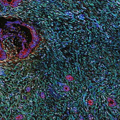 Cover image for research topic "Extracellular Matrix Modifications in Development and Disease"