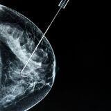 Cover image for research topic "Breast Cancer Imaging: Clinical Translation of Novel Methods"