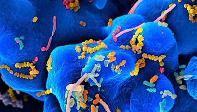 Cover image for research topic "Reducing Neonatal Infectious Morbidity and Mortality: Joining Up Our Thinking"