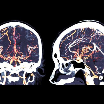 Cover image for research topic "Insights in Neuroradiology"