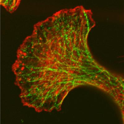 Cover image for research topic "Mechanical Coupling between Extracellular and Intracellular Microenvironment"