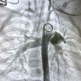 Cover image for research topic "Case Reports in Structural Interventional Cardiology: 2023"