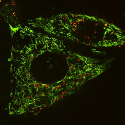 Cover image for research topic "Mitochondrial Communication in Physiology, Disease and Aging"