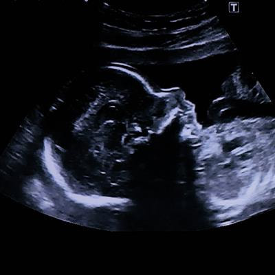 Cover image for research topic "Intergenerational Impacts of Perinatal Mental Health"
