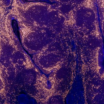 Cover image for research topic "Updates on the management of Glioblastoma"