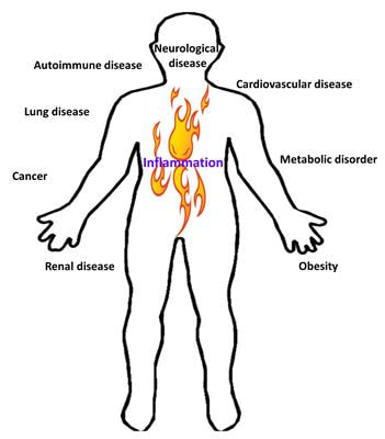 Cover image for research topic "Regulation of Inflammation in Chronic Disease"