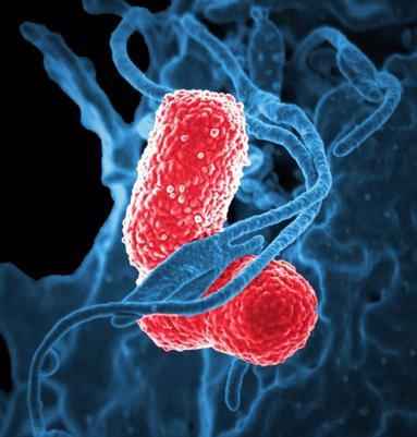 Cover image for research topic "The Twin Threats of Klebsiella pneumoniae Infections: Antimicrobial Drug Resistance and Hypervirulence"