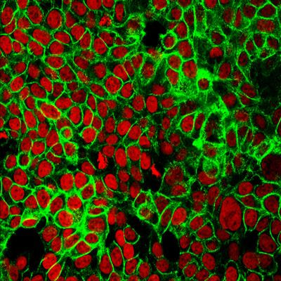Cover image for research topic "Editors' Showcase 2023: Insights in Cell Adhesion and Migration"