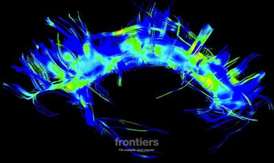 Cover image for research topic "Exercise and Neuroplasticity in Parkinson Disease"