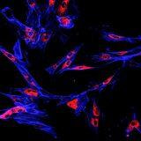 Cover image for research topic "Advances in Molecular and Pharmacological Mechanisms of Novel Targeted Therapies for Melanoma"