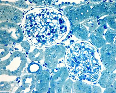 Cover image for research topic "Novel Pathophysiologic Mechanisms and Reno-protective Pharmacotherapies in Diabetic Kidney Disease"