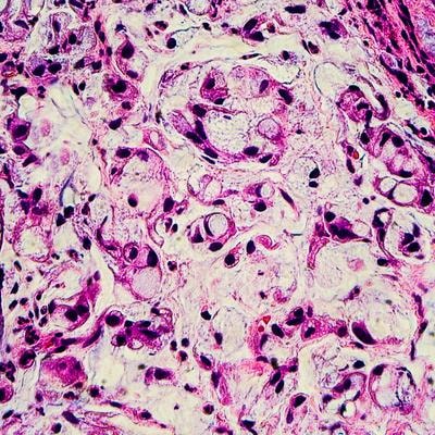 Cover image for research topic "Synthetic and non-synthetic anti-cancer drugs in gastric cancer: emphasis on the RAS/RAF/MAPK and PI3K/AKT/mTOR signaling pathways"