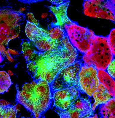 Cover image for research topic "Understanding the Mesenchymal to Epithelial Transition: A Much Needed Angle for Epithelial Mesenchymal Plasticity"