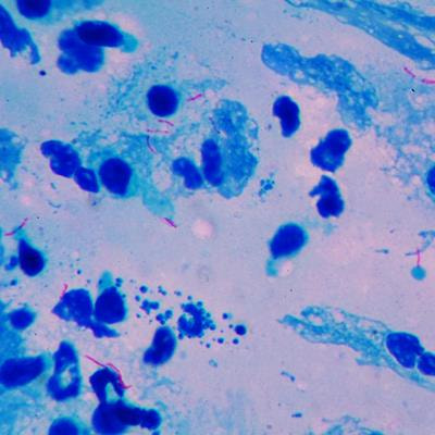 Cover image for research topic "Recent Advancements in mycobacterial diseases research"