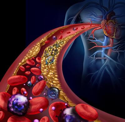 Cover image for research topic "New Trends in Vascular Inflammation Research: From Biology to Therapy"