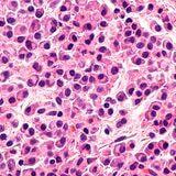 Cover image for research topic "Novel Agents for Multiple Myeloma Vol. II"