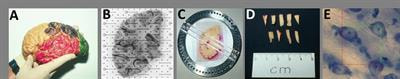 Cover image for research topic "Neurostereology"