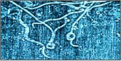 Cover image for research topic "An Infectious Origin of Alzheimer’s Disease: An End for This Devastating Disorder?"