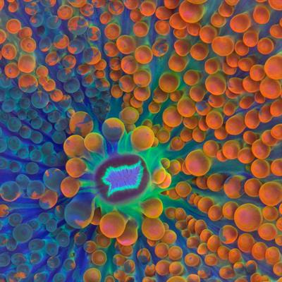 Cover image for research topic "Application of Novel Statistical and Machine-learning Methods to High-dimensional Clinical Cancer and (Multi-)Omics data, Volume II"