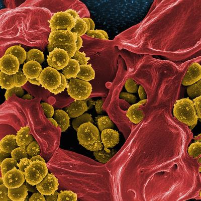 Cover image for research topic "New Insights in Prosthetic Joint Infections"