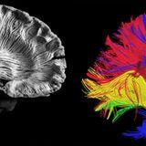 Cover image for research topic "Methods and Applications of Diffusion MRI Tractometry"