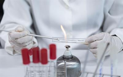 Cover image for research topic "Biomarkers of Sepsis"