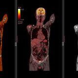 Cover image for research topic "Case Reports in PET Imaging 2023"