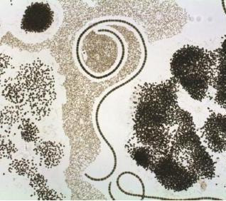 Cover image for research topic "Cyanobacterial Blooms in a Changing World"