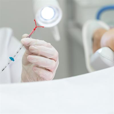Cover image for research topic "Current Advances in Contraceptive Use, Technology, and Promotion"