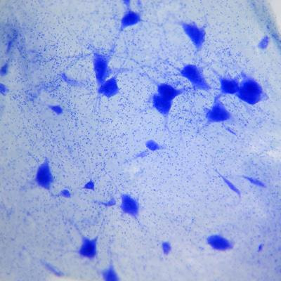 Cover image for research topic "The diagnostic difficulties of immune-mediated neuropathies"