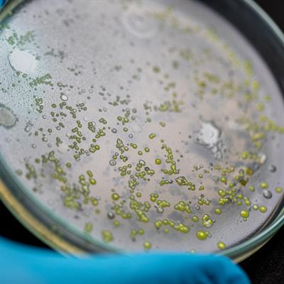 Cover image for research topic "Role of Microbes in the Production and Utilization of Nutrients for Good Health"