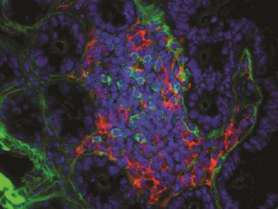 Cover image for research topic "Differentiation and Mechanisms of Activation of Innate Lymphoid Cells"